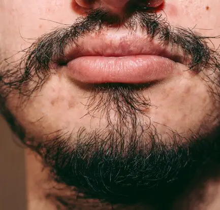 How to Fix Patchy Beard